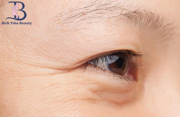 BOTOX ĐA DỤNG